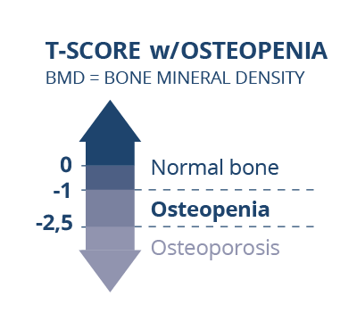 Osteoporosis vs Osteopenia